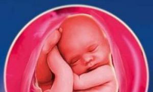 Маловодие при беременности: причины, симптомы, лечение Умеренное маловодие в 31 32 недели